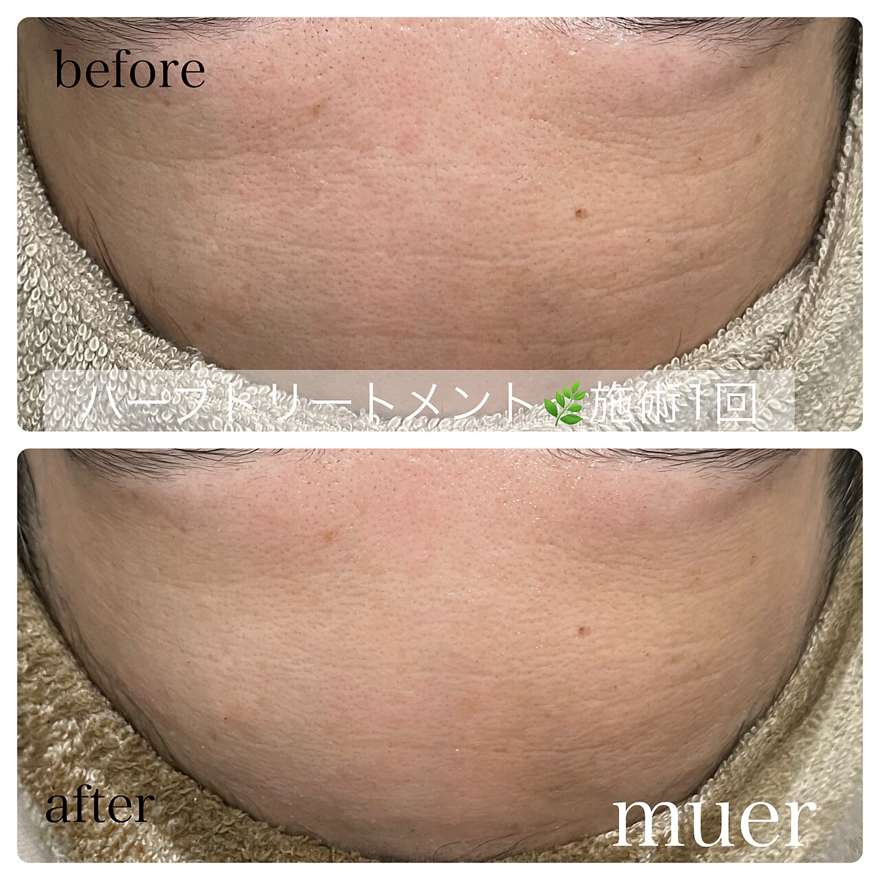 HBL 眉癖改善と眉WAX
