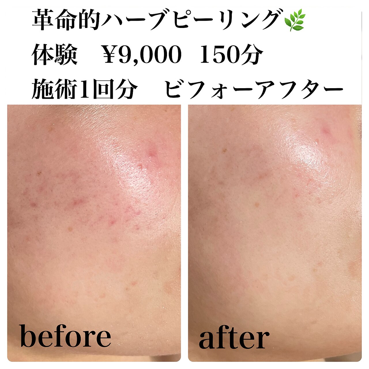 はじめての眉サロン HBLキャンペーン